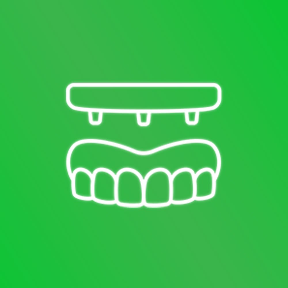 Ideal para quem perdeu um ou vários dentes, atualmente os implantes de carga imediata são uma tendência da odontologia por causa dos avanços científicos na área, que busca aumentar a saúde, a segurança e o conforto na região bucal.